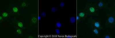 Detection of 53BP1 in NIH3T3 Cells Using Conjugated 53BP1 Antibody